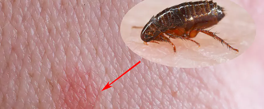 Flea Control for Humans The Colony, TX